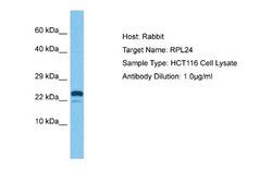 Ribosomal Protein L24 Rabbit anti-Human, Polyclonal, Novus Biologicals